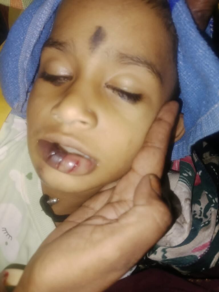 ढगारिया ग्राम में घर पर बैठी पांच वर्षीय छात्रा को दिन में सर्प काटने से मृत्यु ।