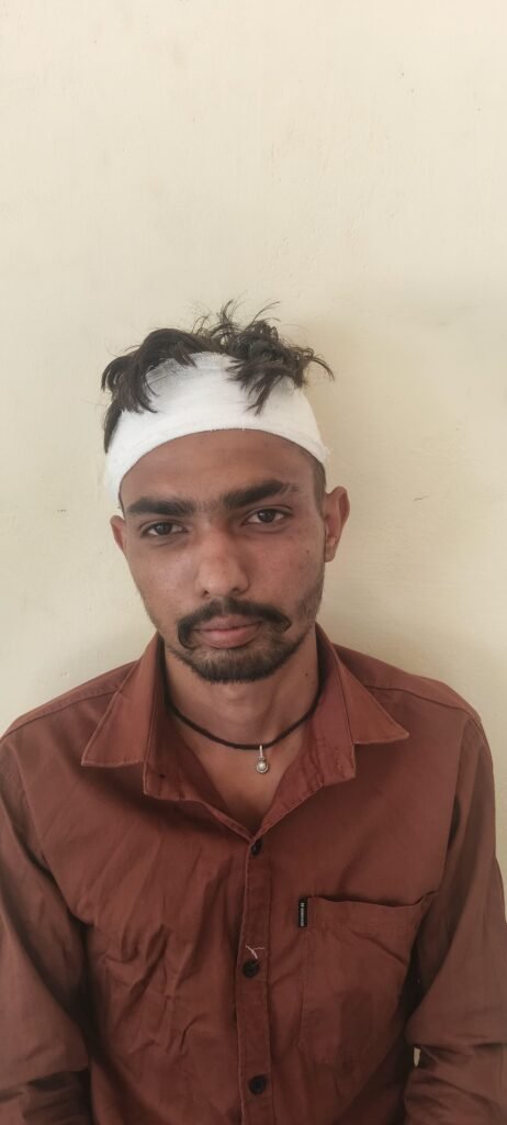 सावर में बारात समारोह के दौरान युवक पर जानलेवा हमला, FIR दर्ज