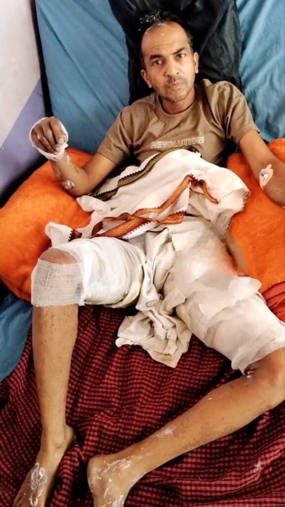 देवास। पांच रुपए की पेप्सी उधार नहीं दी तो तीन युवकों ने दुकानदार पर पेट्रोल छिड़क कर आग लगा दी