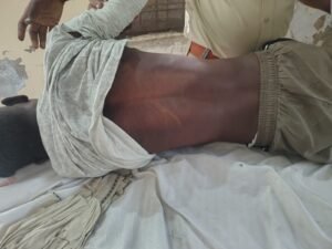 भिंड। मारपीट से आहत युवक ने लगाई फांसी, तीन पर मामला दर्ज